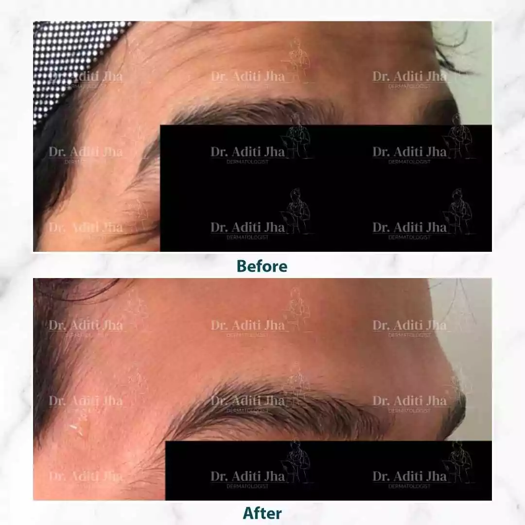 Boyox (side face)