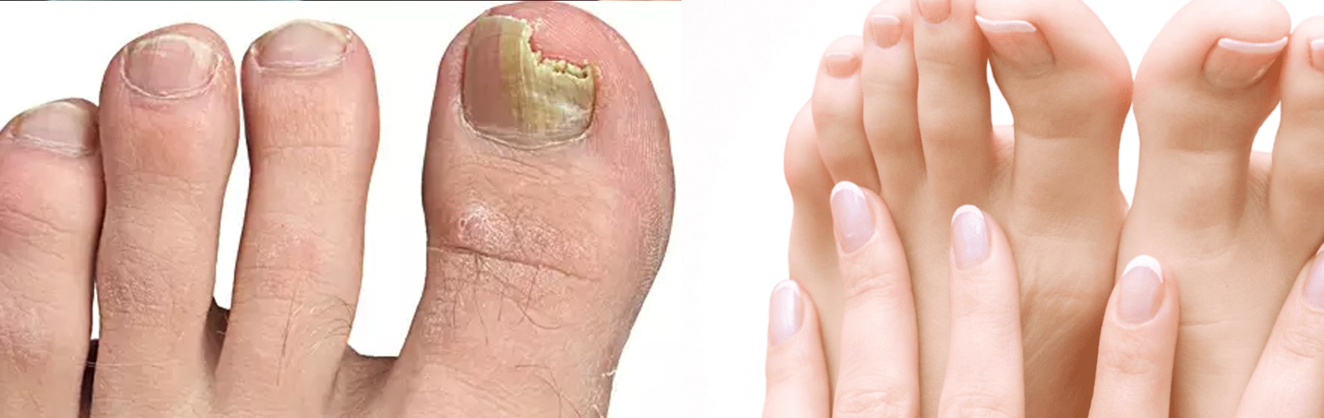 Exeter Nail & Hair problems