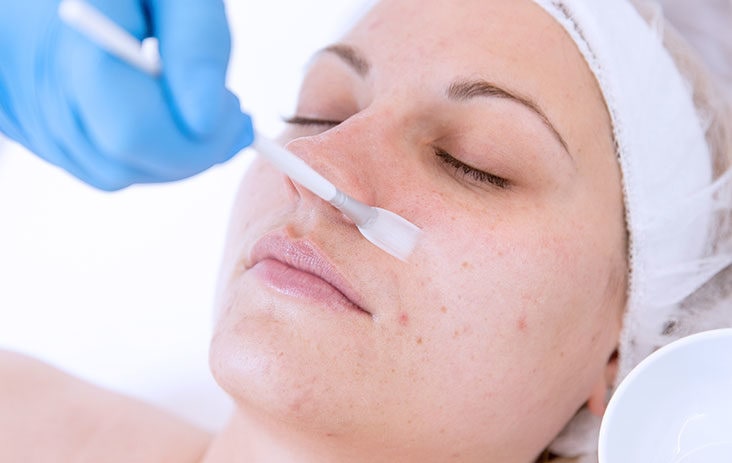 Chemical Peels in Chandigarh