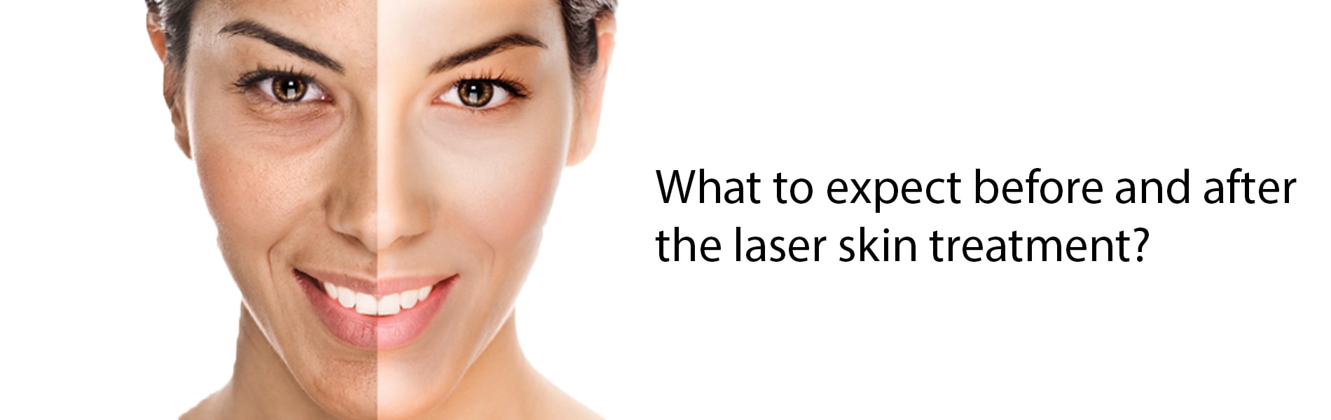 What to expect before and after the laser skin treatment?