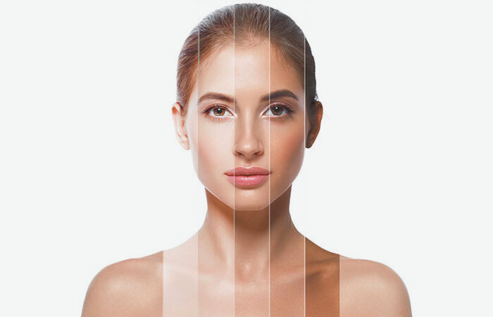 Laser Skin Toning