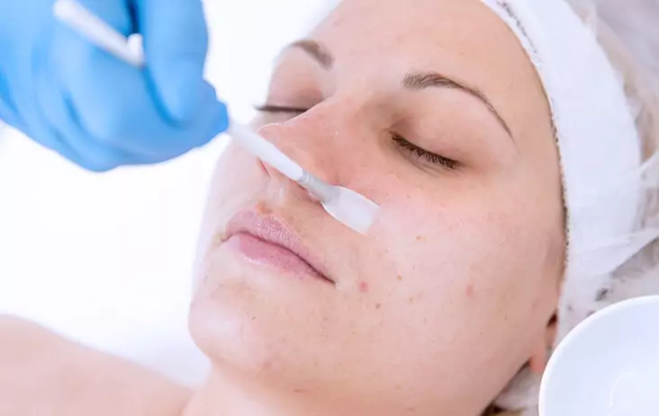 Chemical Peel Treatment Chandigarh