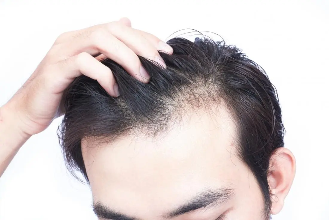 Hair Loss Treatment in Chandigarh