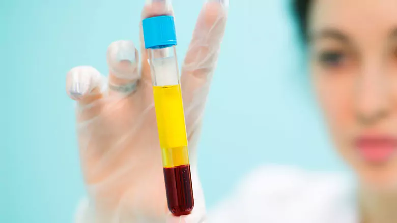 PRP Treatment in Chandigarh