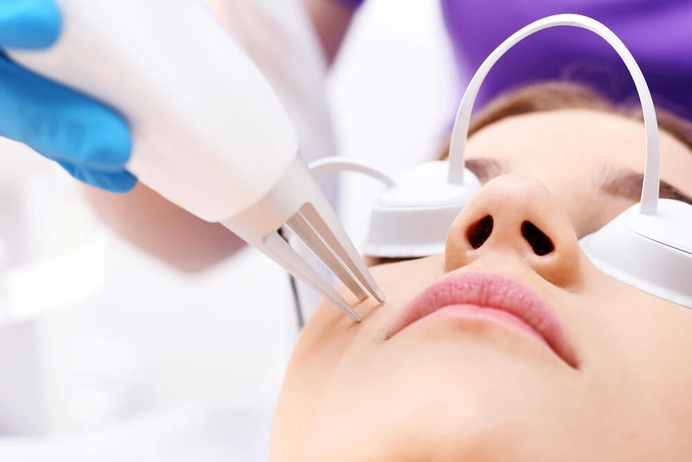 Scar removal treatment in chandigarh