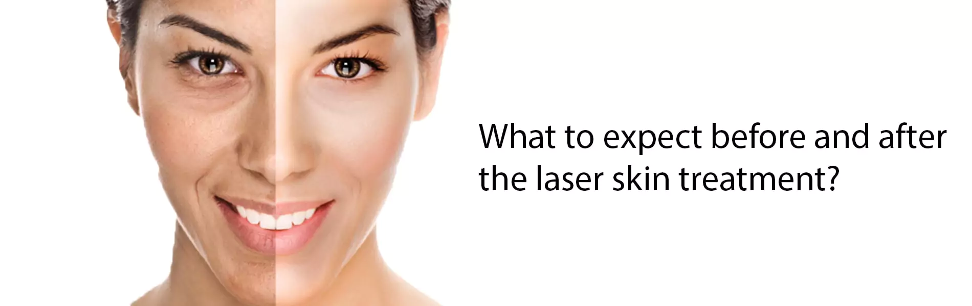 before and after laser skin treatment